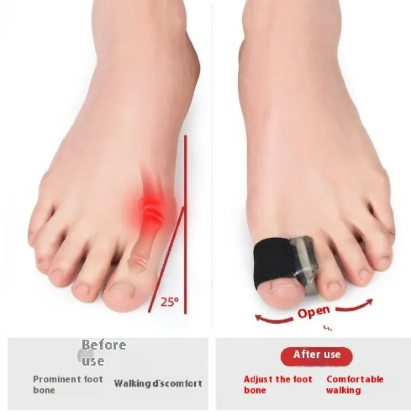 Toe Separator for Bunion Relief – Thumb Valgus Orthotic Splitter